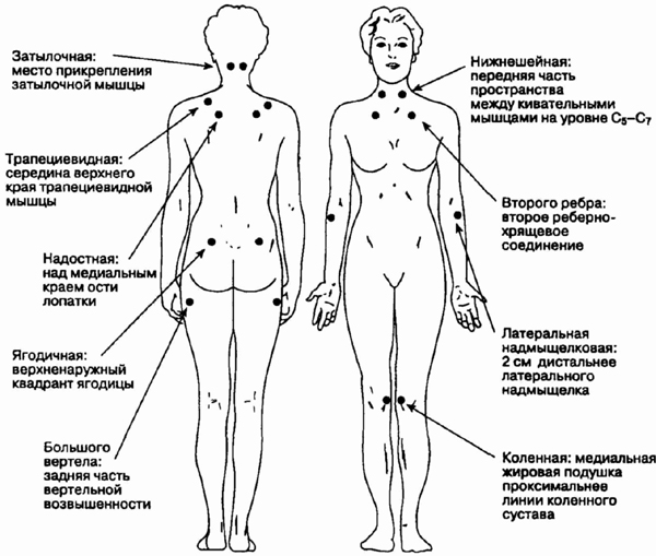 Самые болезненные точки